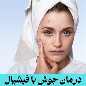 درمان جوش با آکنه